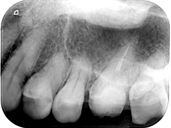 Before image