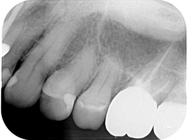 After image