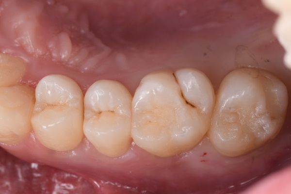Before image