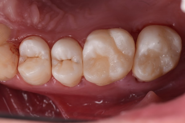 After image