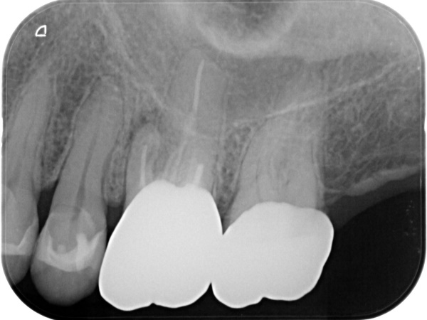 Before image