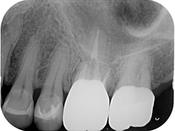 After image
