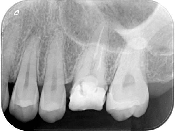 Before image