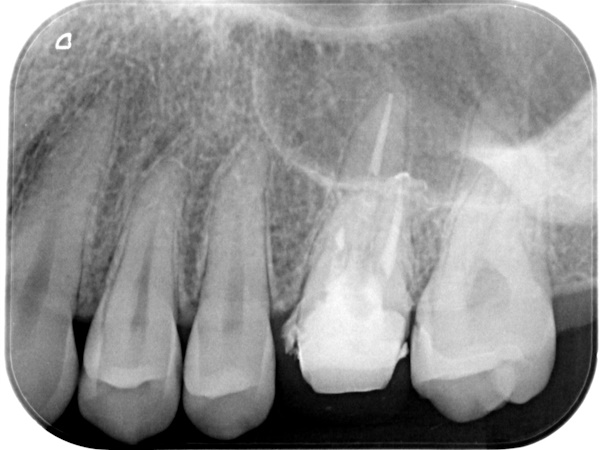 After image