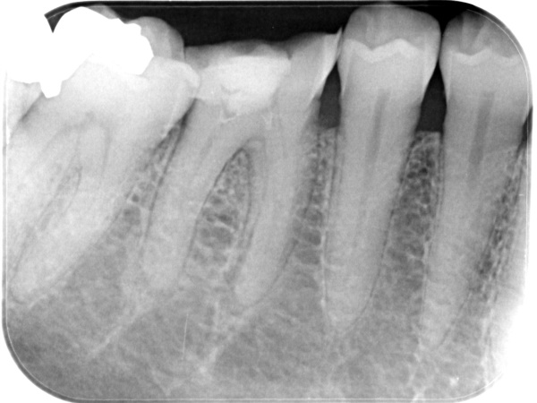 Before image