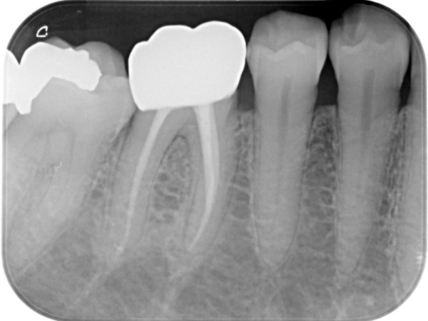 After image