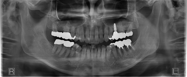 After image