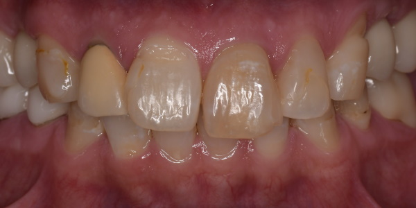 Before image