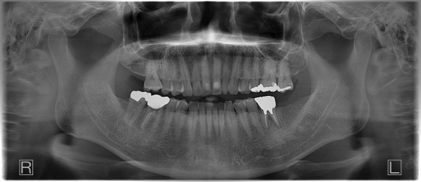 Before image