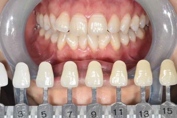 Before image